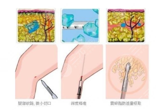 成都八大处医疗美容医院特色项目