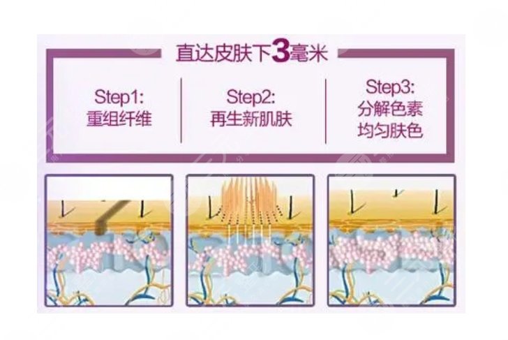 上海华美医疗美容医院祛斑怎么样