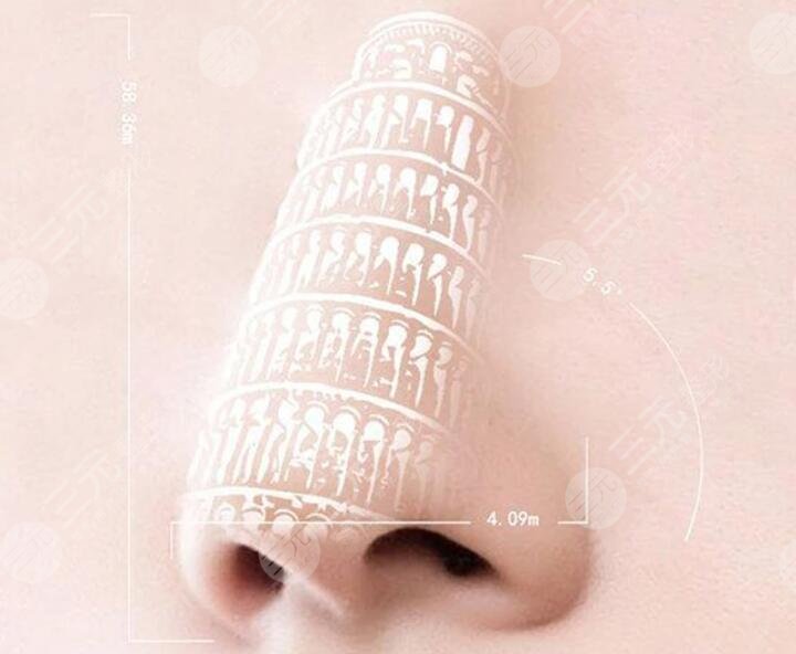 成都徐航做鼻子案例介绍