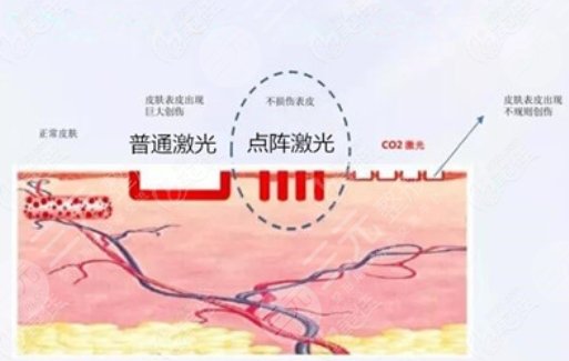 北京美莱整形医院去疤痕怎么样