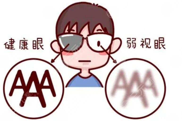 小儿斜弱视