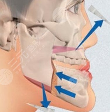 上海华美医疗美容医院擅长项目科普