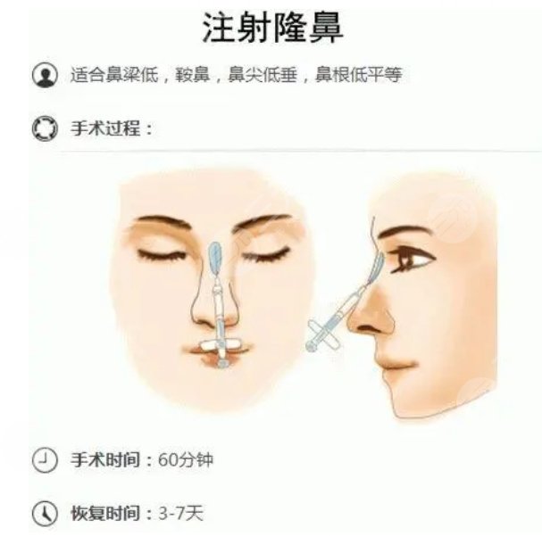 北京美莱医疗美容医院擅长项目科普