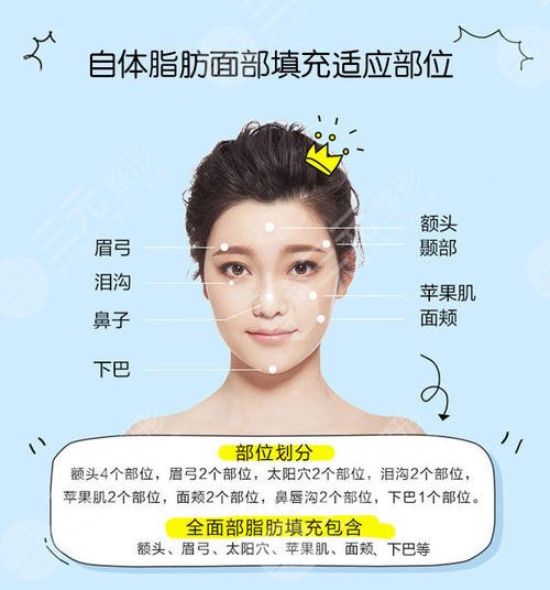 上海长海医院全脸脂肪填充案例