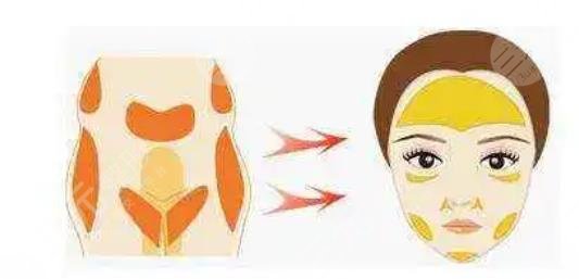 深圳阳光医疗美容医院特色项目