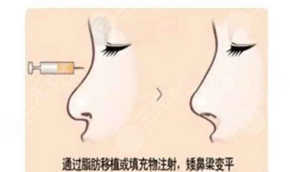 上海华美医疗美容医院擅长项目