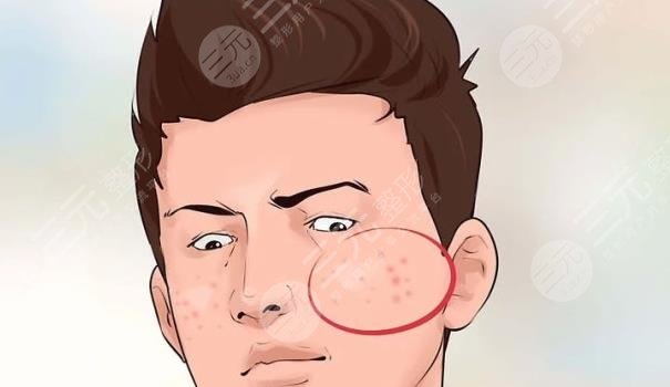 男生怎样美白皮肤？日常注意这3点，还有2款医美项目适合做！