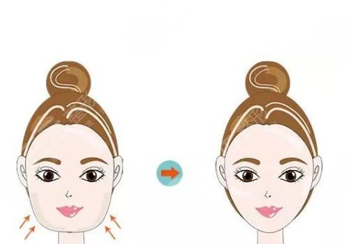 3d下颌角和长曲线下颌角区别是什么