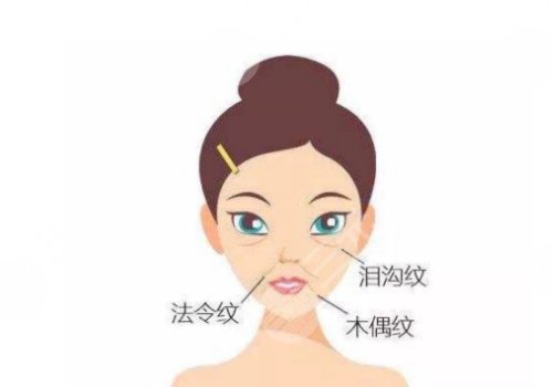 鼻唇沟和法令纹的区别