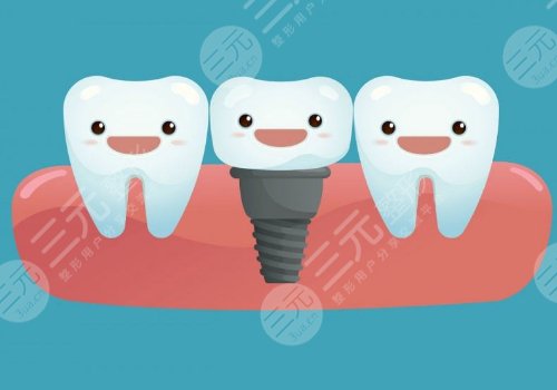 浙江美奥口腔医院种植牙怎么样