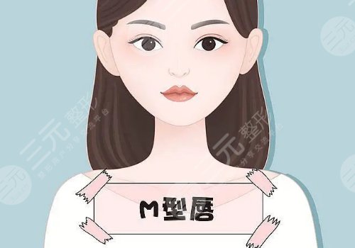 微笑唇整形能维持多久