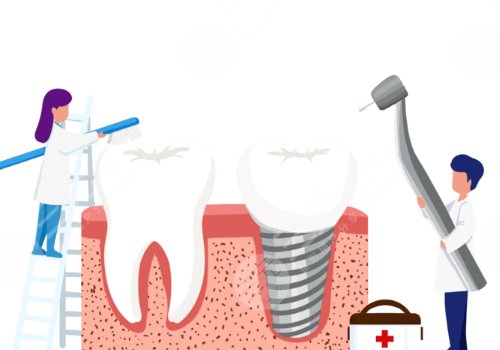 上海美奥口腔医院种植牙价格