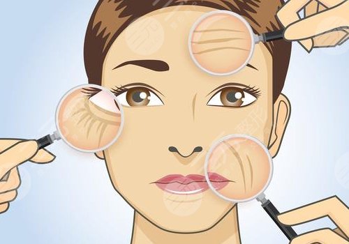 怎么可以消除皱纹