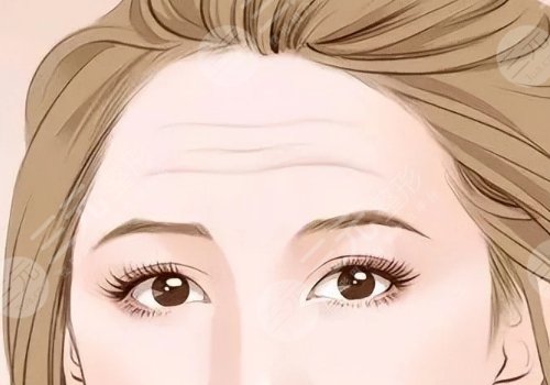 怎么可以消除皱纹