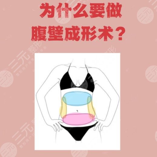 徐礼亮医生腹壁成形如何？手术多少钱？腹壁成形专家实力测评