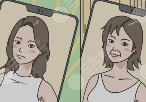 鼻唇沟太深怎么办