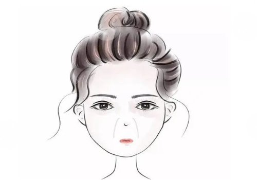 鼻唇沟太深怎么办