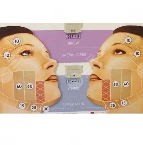 鼻唇沟和法令纹的区别