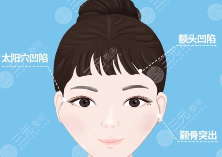 填充颞部