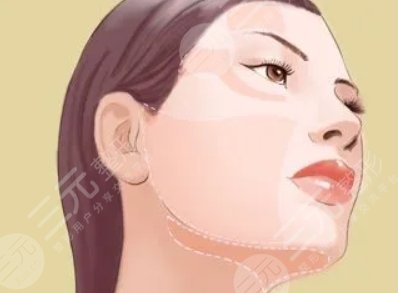 填充颞部