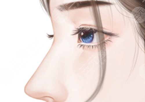 郑州集美张海洋做鼻子当天去可以直接做吗