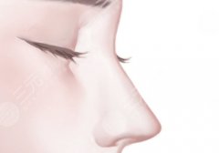 鼻修复可以只改鼻头吗？手术一般多少钱？鼻整形攻略