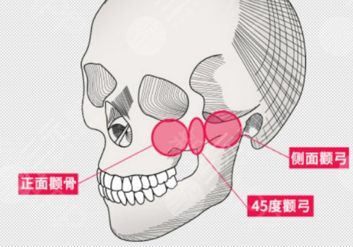 陈小平医生磨骨怎么样
