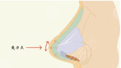 宁波艺星做鼻子医生那个好？卢燕明假体隆鼻结果分享，宁波隆鼻医生合集