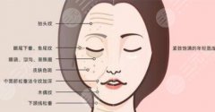 4d网格面部提升价格大概多少钱？2024年市场价10000到30000元左右~
