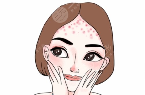 额头长痘痘