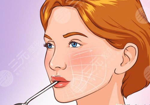 7d聚拉提大概全脸下来多少钱