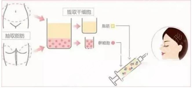 北京美莱医疗美容医院科普知识
