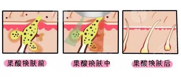  <p style="text-align: center;"> 	<span style="color:#ff0000;"><strong>【想变美吗？预约医生 获取优惠 点击 &rarr;咨询&larr;】</strong></span></p>