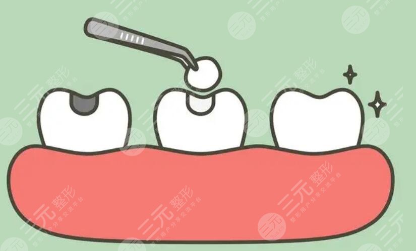 补牙