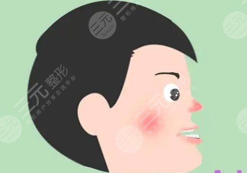 正颌手术风险大吗