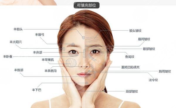 北京张红芳医生?口碑|北京张红芳脂肪填充怎么样?