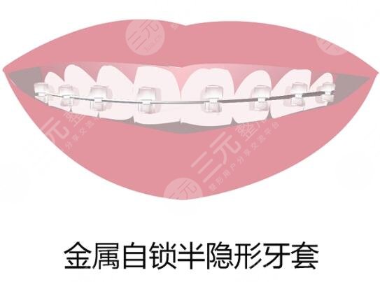 上海七医院口腔科环境怎么样?