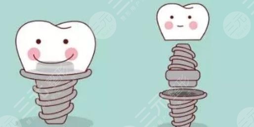 上海东方医院口腔科特色项目