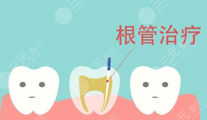 根管缓解