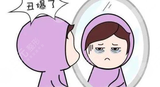 去眼袋