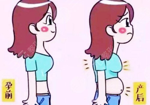 上海时光整形外科医院腹壁成形术多少钱