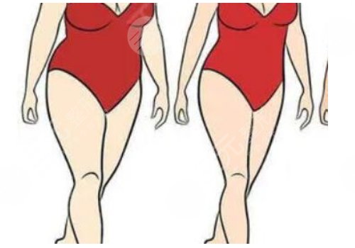 水动力吸脂多少钱一部位