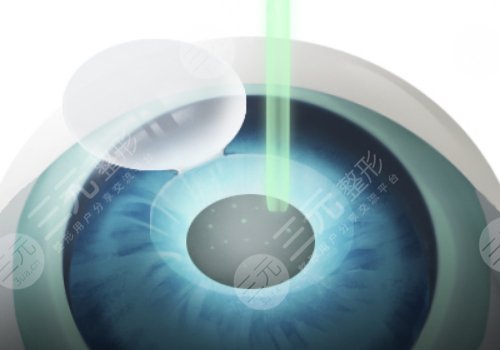 上海长海医院近视手术怎么样