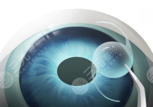 上海长海医院近视手术怎么样