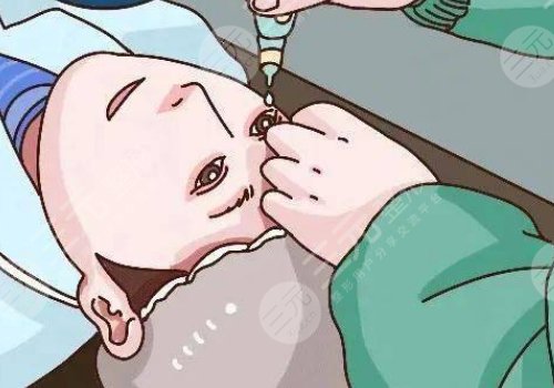 近视手术多少钱