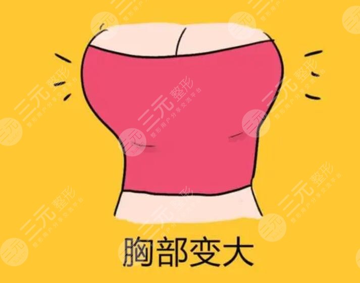 北京王明利医生自体脂肪隆胸案例