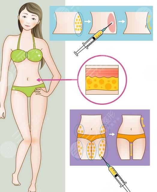 上海八院整形美容科特色项目