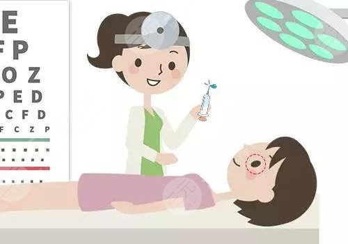 近视眼怎么慢慢恢复视力