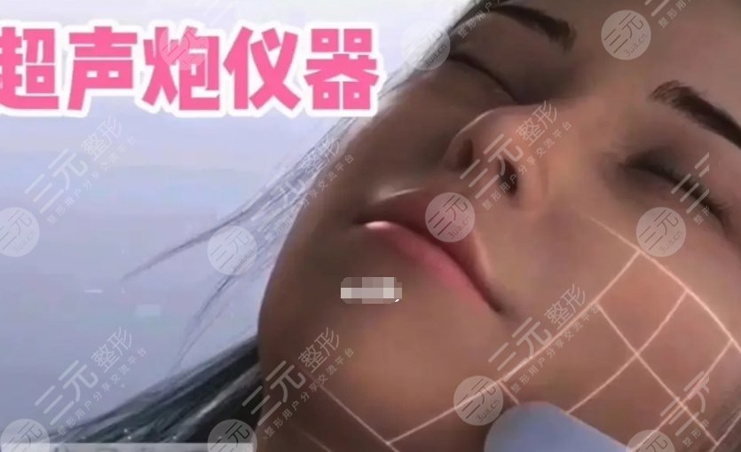 超声炮