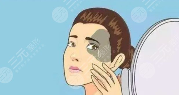 脖子胎记